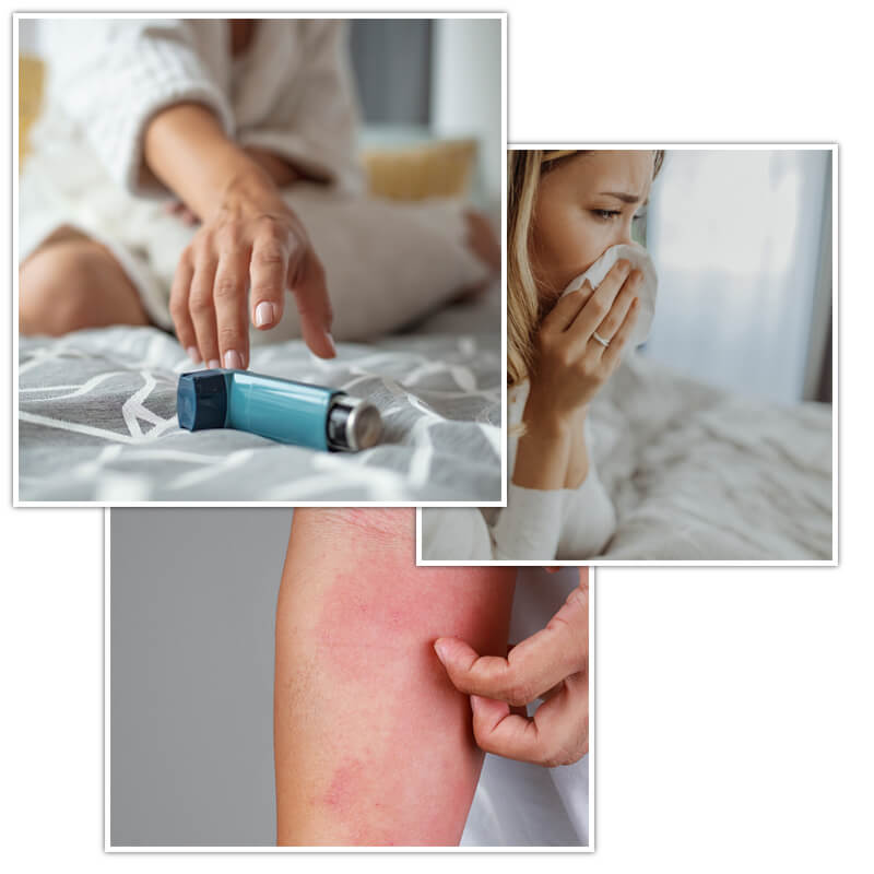 allergies-from-dust-mites-in-london-silent-mites Dust mite removal near me